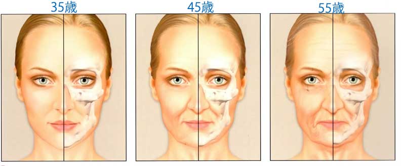 たるみの原因１顔の骨量の減少